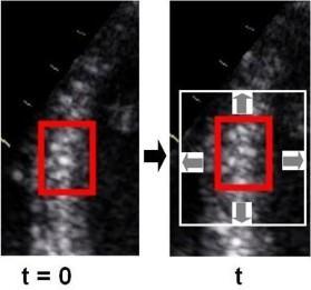 Nel fotogramma successivo, t = t, l algoritmo definisce un area circostante (rettangolo bianco).