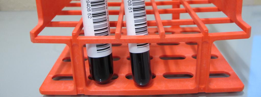 Solitamente per studio su sangue intero vengono prelevate 2 provette, ciascuna contenente un diverso tipo di anticoagulante: per evitare eventuali interferenze nella