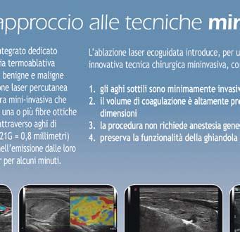 Ciò si spiega facilmente considerando che lo iodio è un costituente fondamentale degli ormoni prodotti dalla ghiandola (tiroxina e triiodotironina), che a loro volta sono essenziali per assicurare un