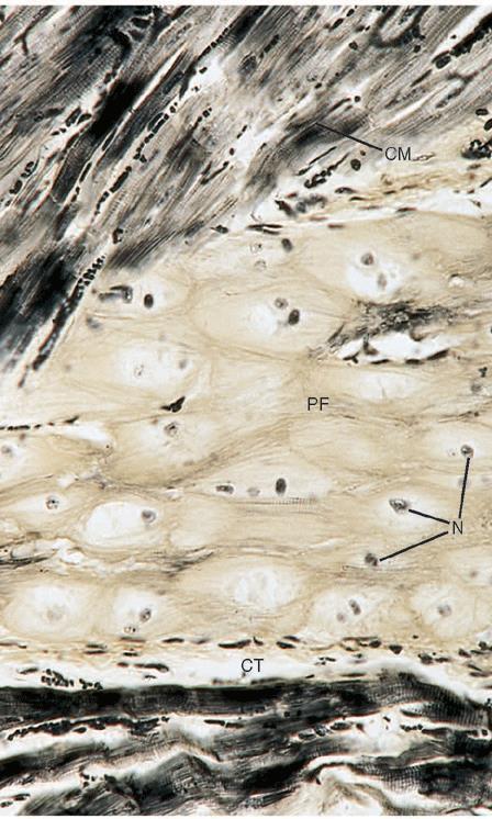 il tessuto specializzato nella conduzione: fascio di His -esso si suddivide nelle branche destra e sinistra che decorrono sotto l endocardio e si suddividono a formare le cellule muscolari cardiache