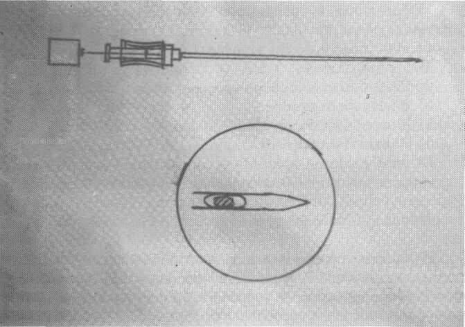 , utilizzando a tale uopo una siringa da insulina di 80 U.I. (2 ml.) (5).