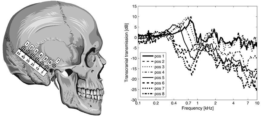 Figure 32: varia la risposta in funzione