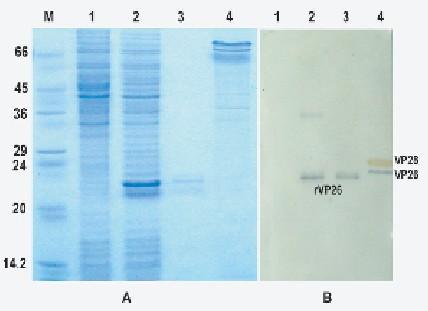 Western blot ll Western blot io immunofissazione è una tecnica biochimica che permette di identificare una determinata proteina in una miscela di proteine, mediante il riconoscimento da parte di