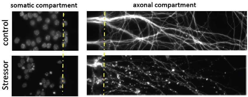 cortical neuronal cultures