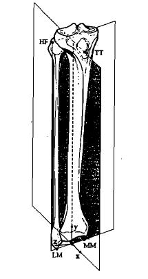 Figura 2.22. Posizione dei marker del bacino e della gamba [6] Figura 2.23. Sistemi di riferimento del bacino e del femore [6] Figura 2.24.