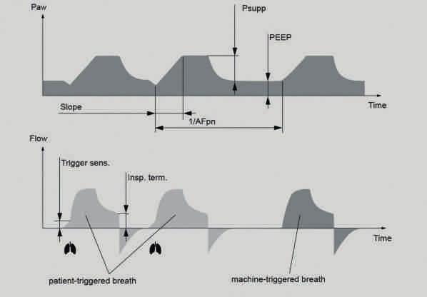 03 Sincronizzazione e supporto alla respirazione spontanea Le apparecchiature per anestesia correnti permettono di sincronizzare la ventilazione meccanica con la respirazione spontanea del paziente.