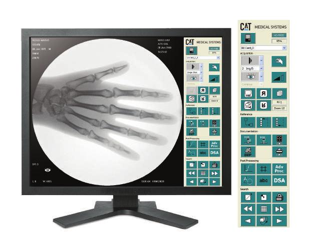 Mirror DII Sistema digitale di acquisizione ed elaborazione delle immagini di scopia Digital system for the acquisition and processing of R&F images for Helios SFD.