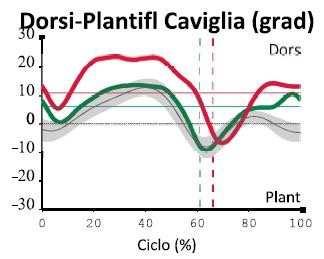 MACRODATTILIA DEL PIEDE - ALTERAZIONI DEL