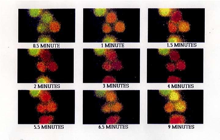 L aumento di Ca 2+ libero intracitoplasmatico è transiente LAT SOS Ras MAP chinasi