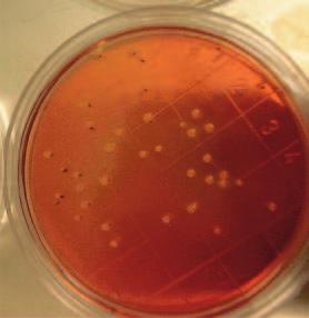 re e/o danneggiare le cellule microbiche mantenendone la vitalità ma inficiandone la coltivabilità in laboratorio.