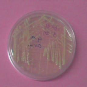 Le colture pure della colonia si ottengono tramite ripassi su terreno agarizzato o, nel caso del protocollo propedeutico alla conservazione a basse temperature, in terreno liquido (v.