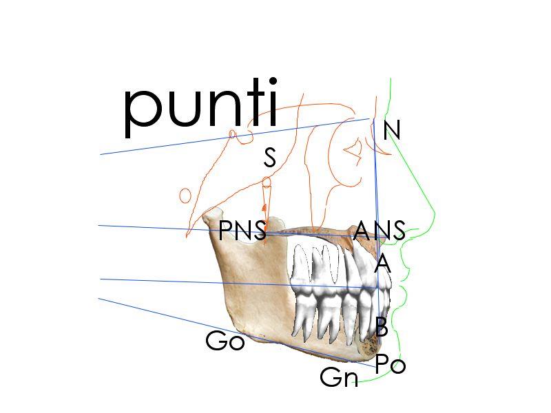 Ori : Punto orbitale inferiore punto di passaggio tra pavimento dell orbita e margine orbitale esterno. A: Punto più retruso del margine anteriore del mascellare.