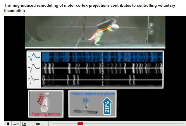 the paralysed muscle. The stimulation is controlled in such a way that the movement produced provides useful function.