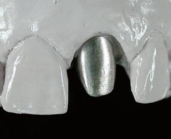ARMATURA Rifinire usando una speciale fresa a dentatura alternata in metallo duro, da usare unicamente per lavorare il titanio.