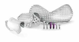 lia per rigenerazione ossea 3D-MESH è un dispositivo medico impiantabile su misura per il singolo paziente, realizzato in conformità alla direttiva 93/42/CEE e s.m.i. Utilizzata dai medici dentisti