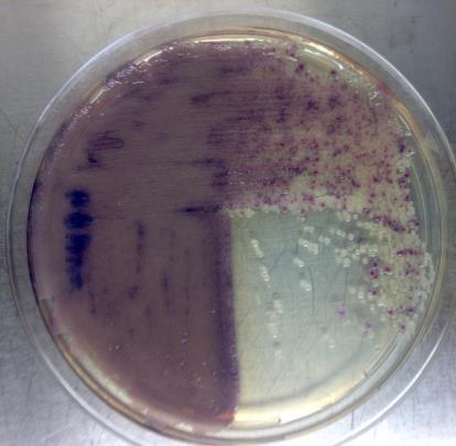 A: CRHOMagar con colonie positive O104 (viola);