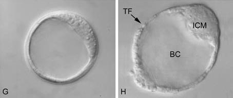 blastomeri; G, blastocisti espansa con