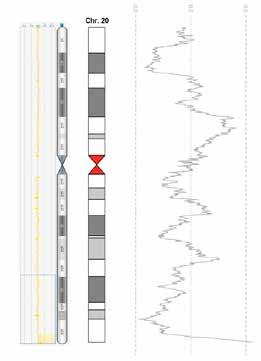 (duplicazioni/delezioni) sui cromosomi non indagati. La gestante ha potuto eseguire interruzione della gravidanza a 15 settimane.