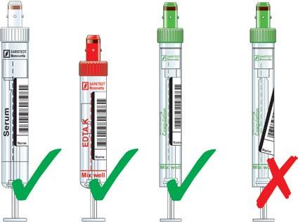 siero/siero gel in posizione verticale per 30 minuti VES EDTA Potrebbero interessarla