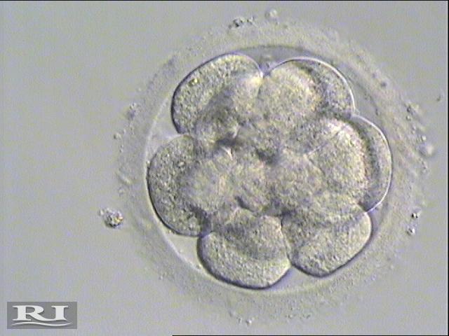 Il transfer degli embrioni può essere effettuato dopo 2-3-5 o 6 giorni giorni dopo il prelievo ovocitario.