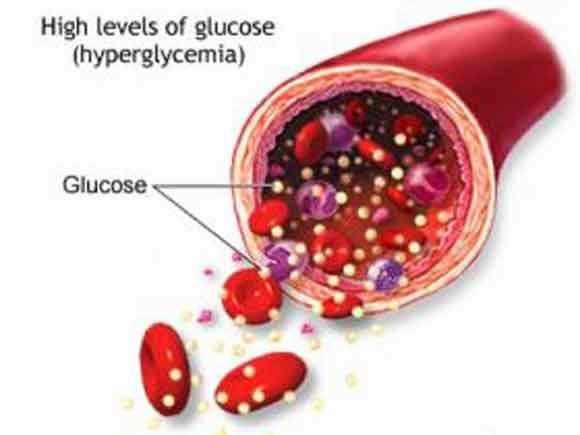 ha durante un'intensa attività fisica, oppure se saltiamo un pasto, grazie alle riserve contenute nel fegato, l'organismo sano riesce a mantenere costante il livello di zucchero nel sangue.