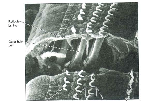 Le cellule cigliate (i) Esistono due tipi di cellule cigliate, interne ed esterne, che differiscono fra loro: Per la posizione che occupano sulla membrana basale (vicino al modiolo o verso l esterno