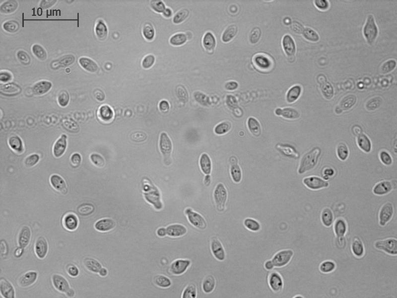 Hanseniaspora uvarum