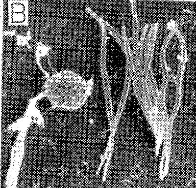 internodi infezione spighe, ovari Tilletia caries e T. foetida (plantule) carie del grano.