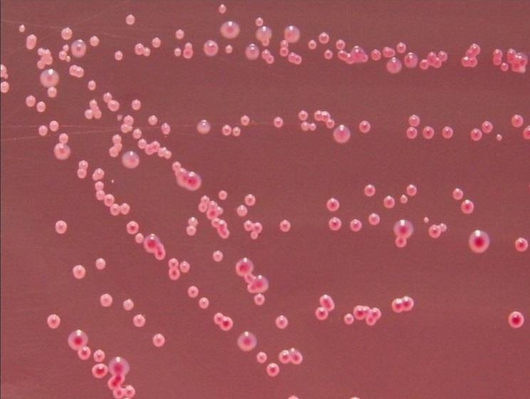 Figura 7: Colonie di Yersinia enterocolitica su endo agar, particolare. Immagine rielaborata da https://www.microbiologyinpictures.