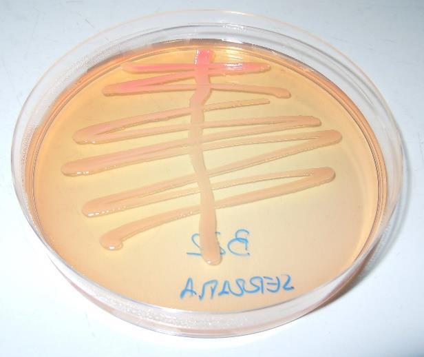 analizzati da questo studio hanno mostrato buona sensibilità agli antibiotici. Coton et al. (2012) isolano Serratia spp. da forme di formaggio, sia dalla superficie che dal centro.