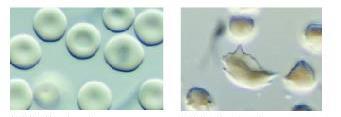 L anemia falciforme: 2 tipi di globuli rossi (a) Eritrociti contenenti emoglobina normale (A): Hb A Hb A (b) Eritrociti