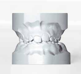 Elite Ortho Gesso tipo 3 per modelli in ortodonzia La lucentezza del
