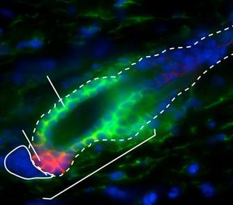 Le cellule staminali che sono nella BULDGE REGION hanno 2 differenti modelli di migrazioni: BULGE-Epidermal Ascendente BULGE-Hair Discendente SVILUPPO DEL FOLLICOLO PILIFERO CELLULE STAMINALI DEL