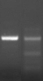 Appendice B tumorali FFPE con un'elevata percentuale di cellule tumorali.