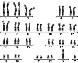 Ciclo cellulare, cromosomi e mitosi centromero A scanning electron micrograph of a human X chromosome.
