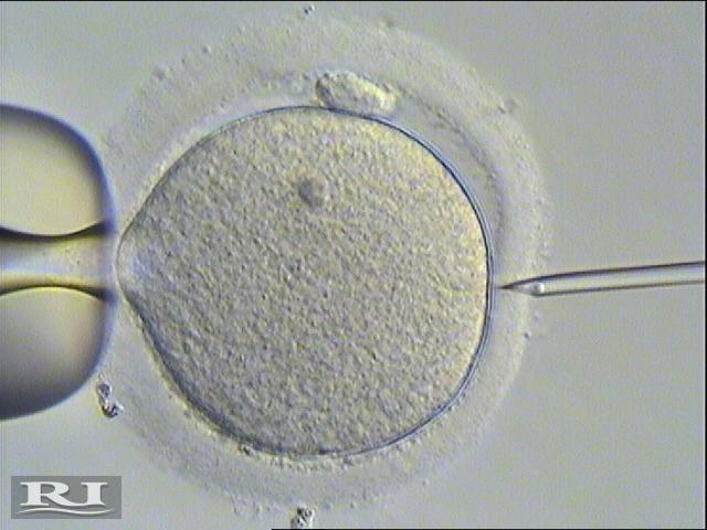 Futura diagnostica Pag. 6 di 15 Americana di Riproduzione Assistita procedendo al trasferimento di massimo 2 embrioni soprattutto in caso di primo ciclo.