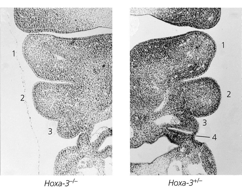 Inattivazione genica L inattivazione di Hoxa-3 porta a morte gli omozigoti In questi topi timo, tiroide e paratiroidi non sono presenti o sono malformati Inattivazione di Hoxa-2