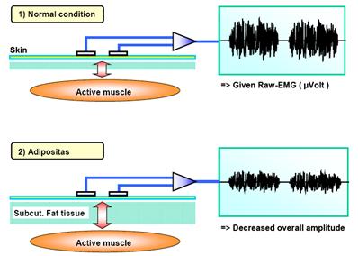 Fattori che influenzano il segnale EMG Fattori che influenzano il segnale EMG Caratteristiche del tessuto: Tipo di tessuto Spessore del tessuto Temperatura Cambiamenti fisiologici Cross talk