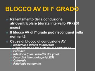 Nel frattempo il fascio di Kent ha già trasmesso l impulso ai ventricoli e di conseguenza l onda R comincia più vicina alla P e tende ad avere una pendenza,