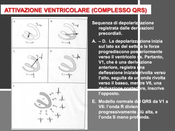 ) Il complesso QRS rispetto alla onda P presenta più deflessioni perché le diverse porzioni dei ventricoli difficilmente hanno un unico vettore medio di attivazione, è vero che poi il vettore