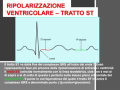 Che cosa è invece il tratto ST? è l intervallo tra la depolarizzazione e la ripolarizzazione ventricolare ed è rappresentato da un tratto isoelettrico.