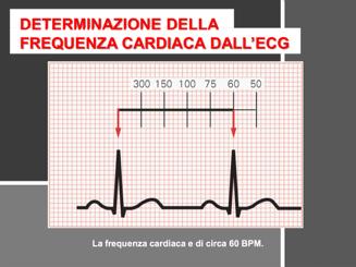 4. NEUROLETTICI: sono gli antipsicotici prevalentemente che tra i tanti effetti possono interferire con il mantenimento del potenziale di membrana, esponendo al rischio