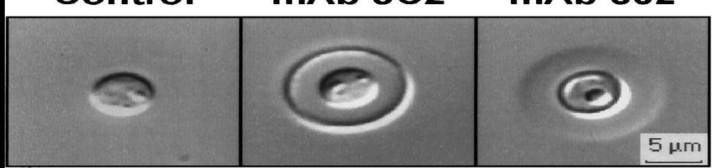 Quellung reaction Criptococcus neoformans è un fungo che produce una grossa capsula polisaccaridica (GXM).