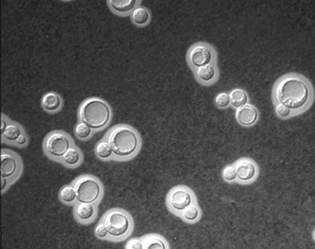 DIC, il legame di anticorpi monoclonali può produrre due distinte reazioni capsulari che dipendono dalla specificità degli anticorpi