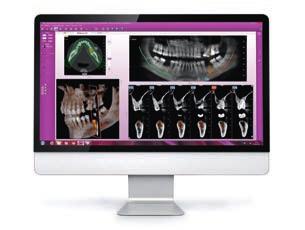 RXDC Radiografico con tecnologia extend.