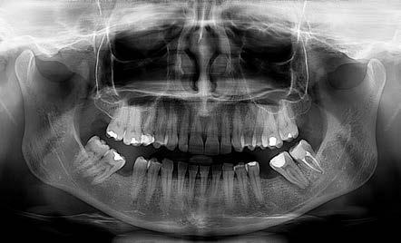 Con il 3D puoi valutare tutti i punti di interesse diagnostico nel loro contesto anatomico, ben oltre la panoramica tradizionale.