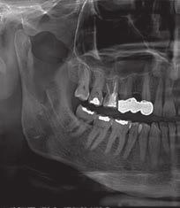 Multi-Desktop 3D/2D 2D PiE (Panoramic Image Enhancer) 3D SMART (Streak Metal Artifacts Reduction Technology) Simulazione implantare MULTI-DESKTOP 3D/2D 2D PiE 3D SMART SIMULAZIONE IMPLANTARE Un