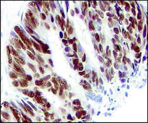contro gli anticorpi di coniglio marcatore Immunofluorescenza: Fibroblasti embrionali di topo T3T; tubulina in verde e DNA in