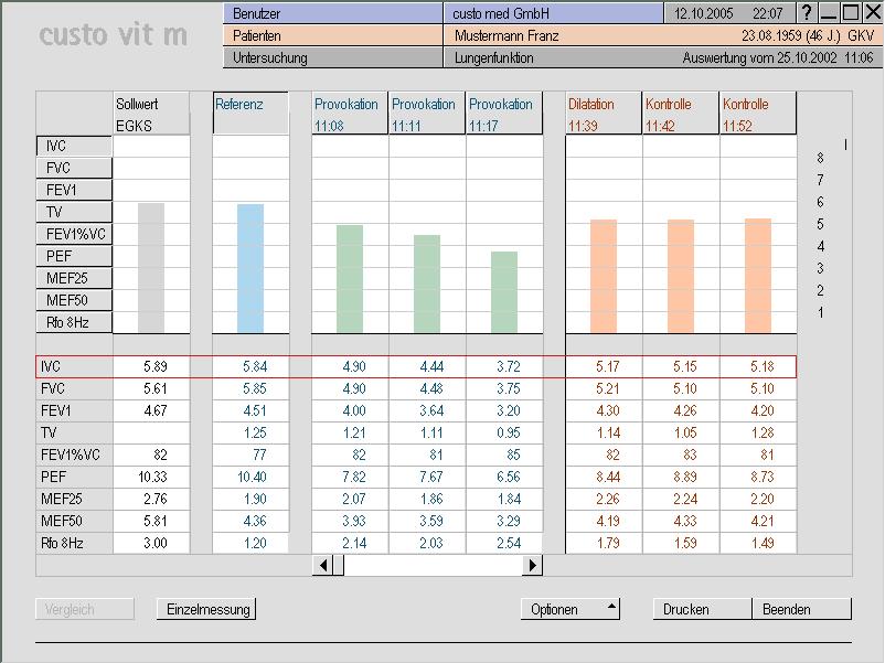 LUMED srl Confronto grafico tra le prove della stessa sessione:. sintesi grafica.