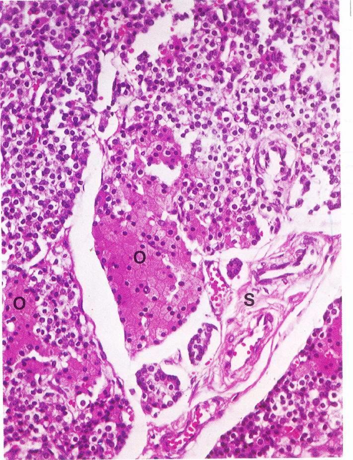 PICCOLI Organi pieni capsula, stroma, parenchima GHIANDOLE PARATIROIDEE Nidi o cordoni cellulari tra cui decorrono numerosi sinusoidi c.